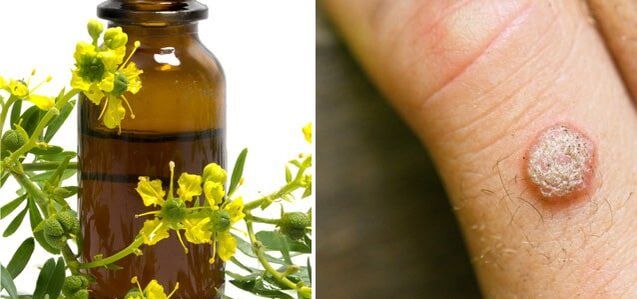 tratamento de verrugas con celidonia farmacéutica